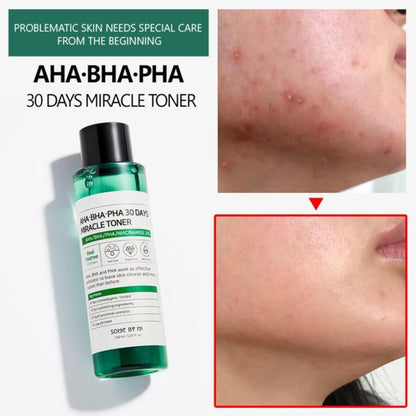 AHA BHA PHA 30 Days Miracle Toner