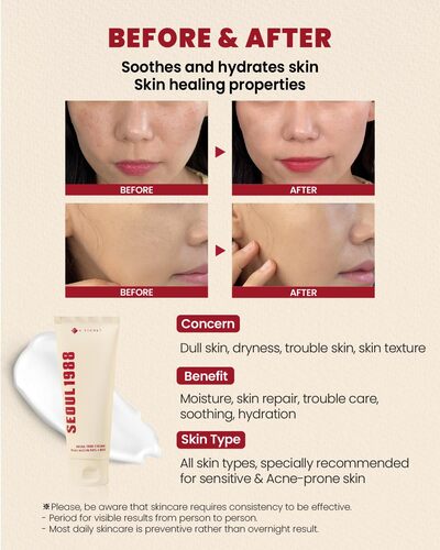 K - SECRET SEOUL 1988 Cream: Snail Mucin 93% + Rice 100 ml