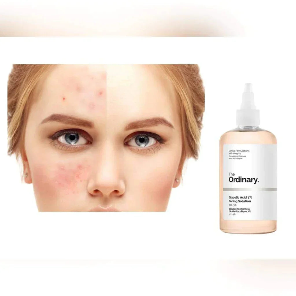 The Ordinary Glycolic Acid 7% Exfoliating Toner - Buy Now Pakistan