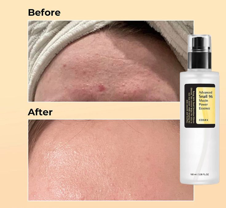 COSRX Advanced Snail 96 Mucin Power Essence 100ml bottle with snail secretion filtrate for hydration and skin repair