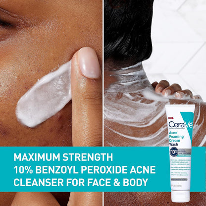 CeraVe Acne Foaming Cream Cleanser with 4% Benzoyl Peroxide