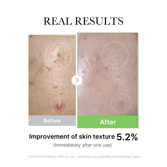 Medicube Exosome Cica Tea Tree Cream 50ml