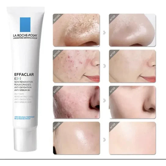 La Roche Posay EFFACLAR K+