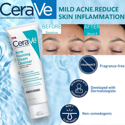 CeraVe acne control cream Cleanser - Buy Now Pakistan