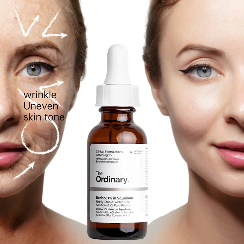 The Ordinary | Retinol 1% in Squalane